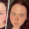 She lost half her body weight in one year after &apos;yo-yo dieting&apos; for years